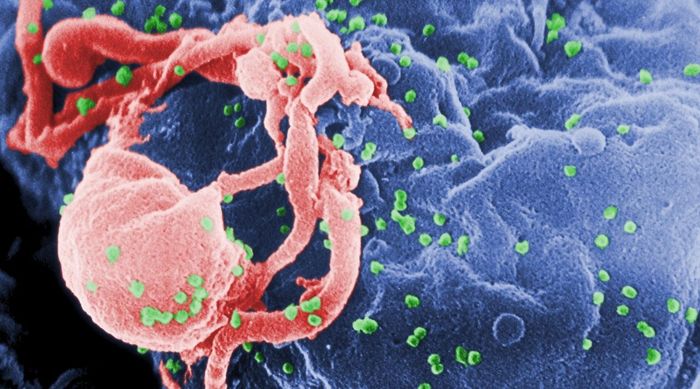 Scanning electron micrograph of HIV-1 budding from cultured lymphocyte. The multiple round bumps on cell surface represent sites of assembly and budding of virions.  Credit: CDC