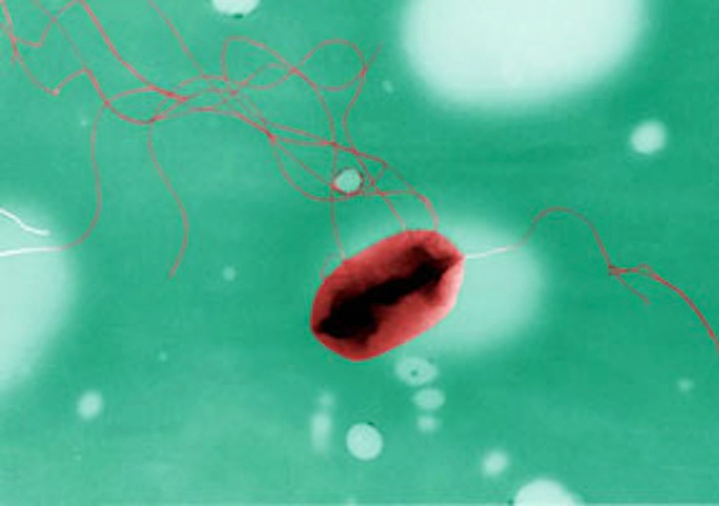 E. coli O157 from Wikimedia Commons