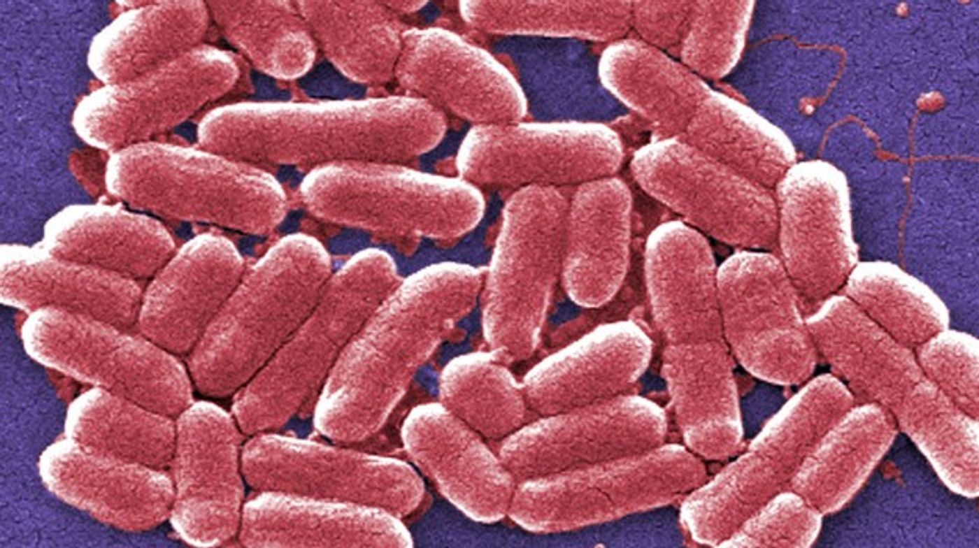 Shigella infects cells in the colon.