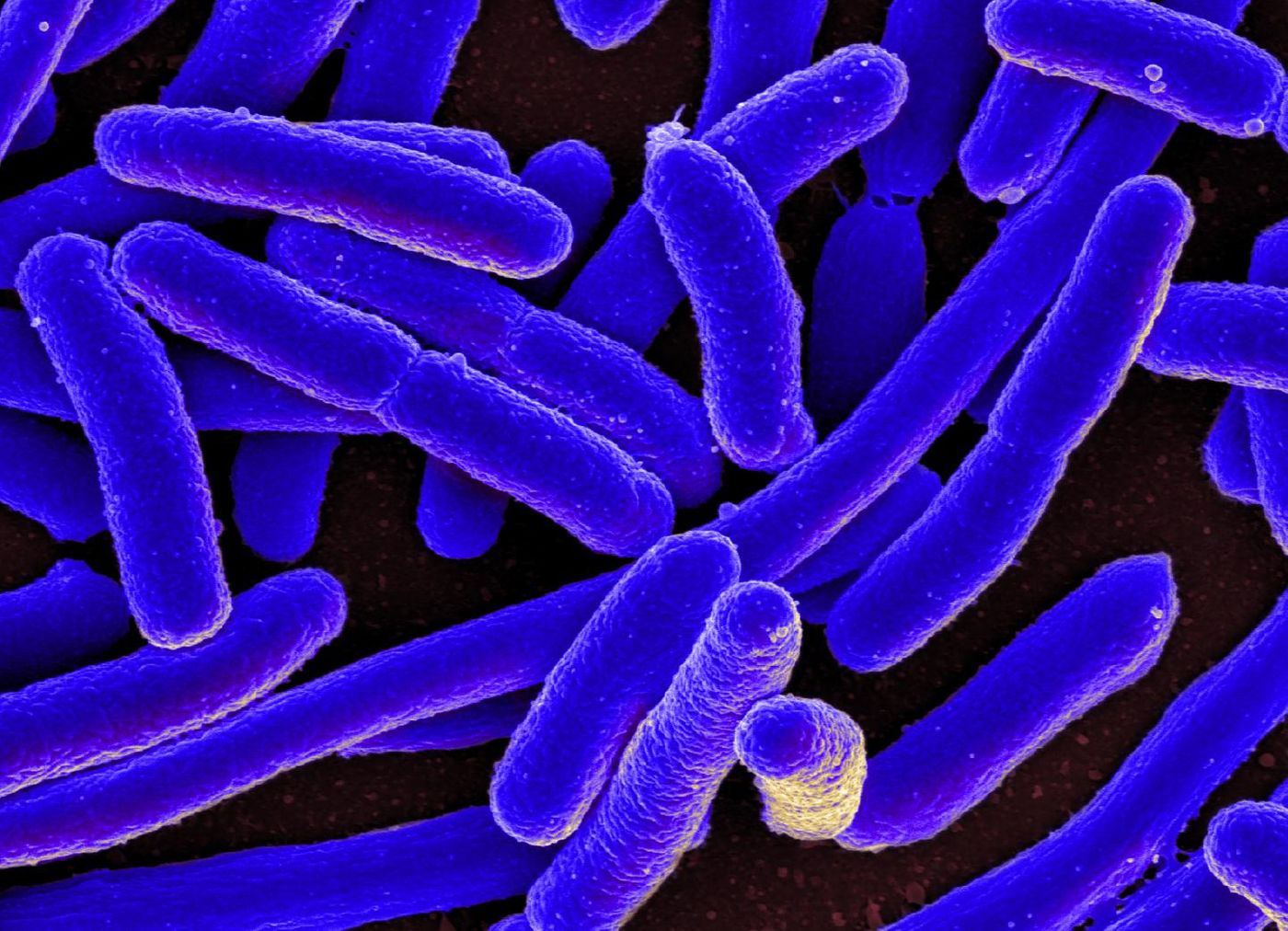E. coli bacteria was used to study the sequences in DNA where the risk for mutation is significantly elevated. / Credit: National Institute of Allergy and Infectious Diseases