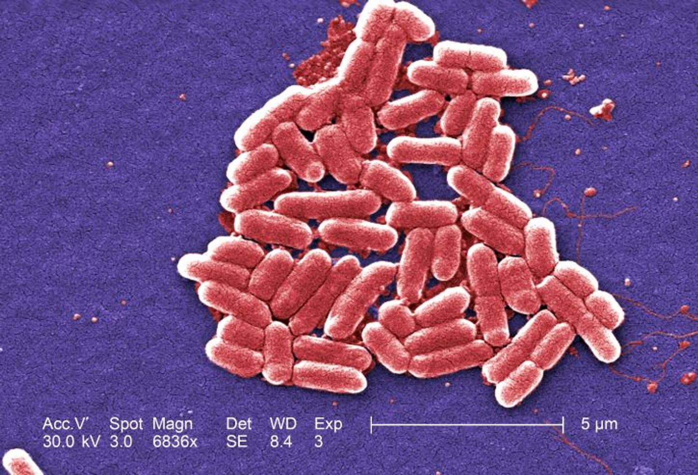 E. coli bacteria / Image credit: Pixnio