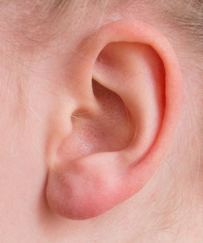 Novel Approach Developed for Ear Replacement Surgery |  Health And Medicine