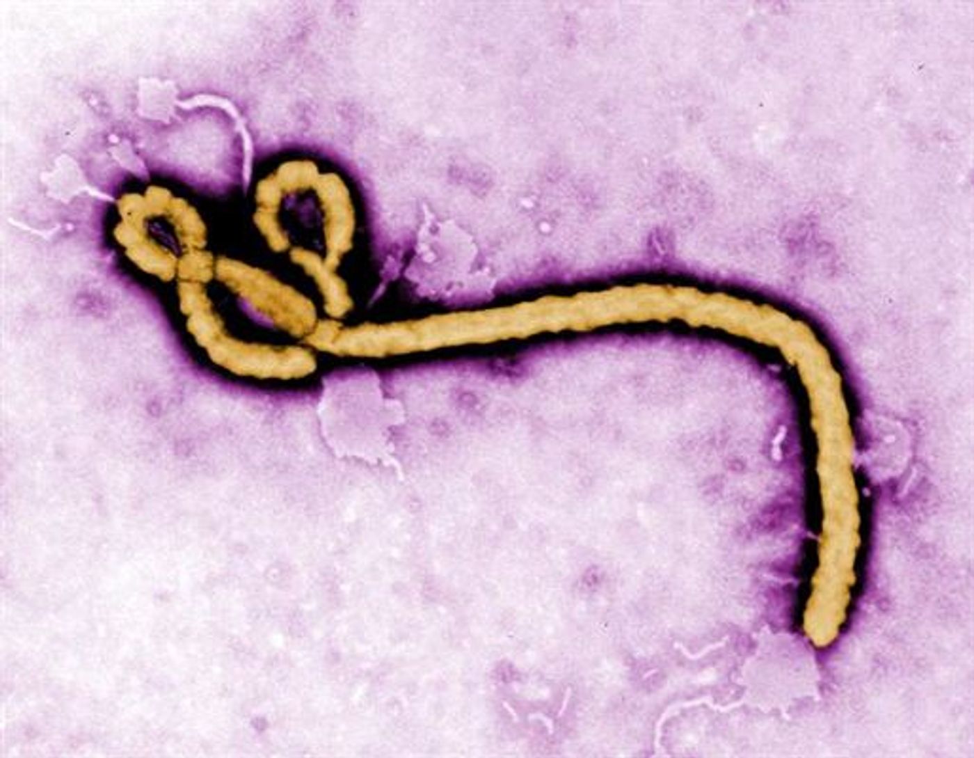 This colorized transmission electron micrograph shows some of the ultrastructural morphology of an Ebola virus virion. CDC photo by microbiologist Frederick A. Murphy, National Center for Infectious Diseases, Special Pathogens Branch