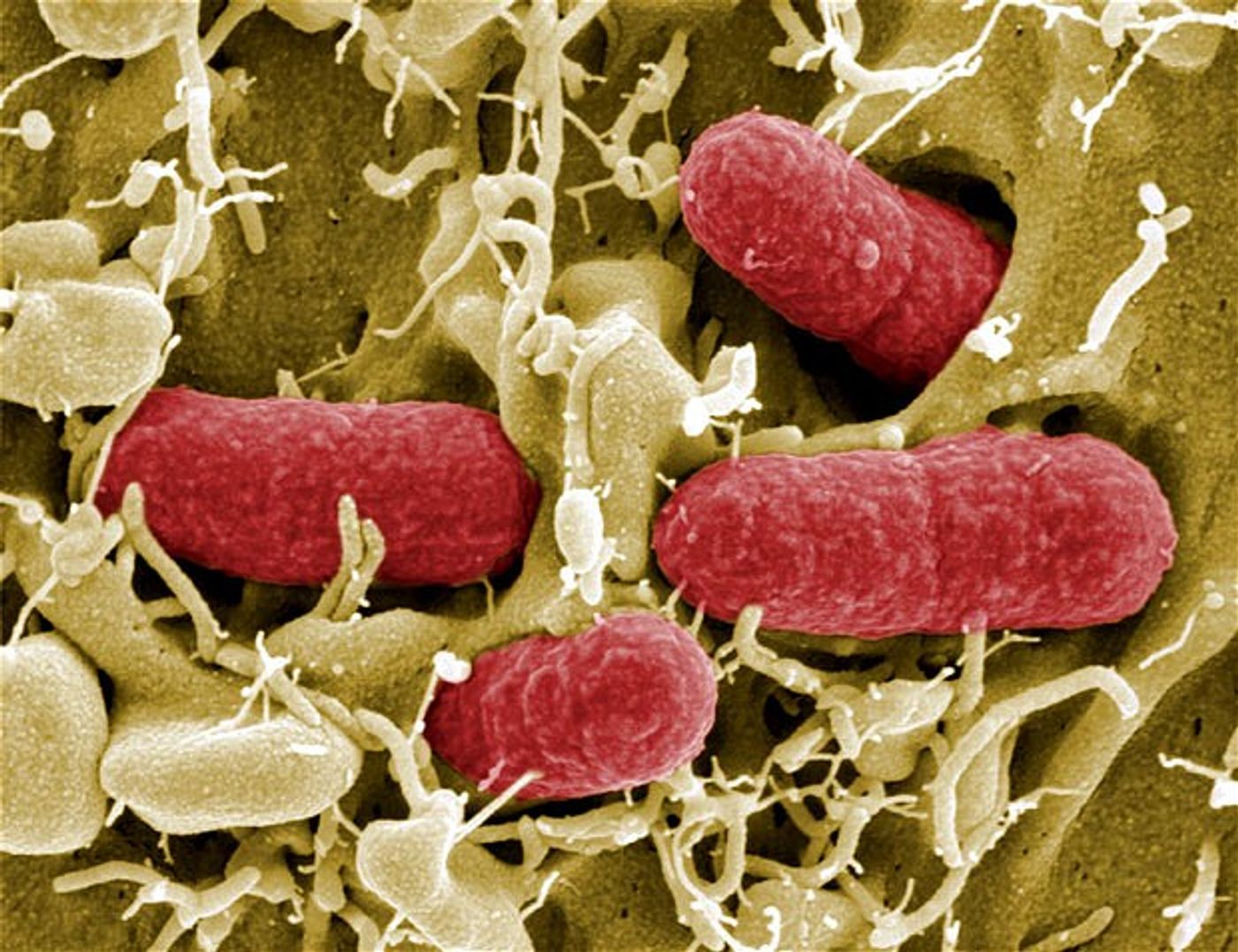 Electron microscopy image of E.coli