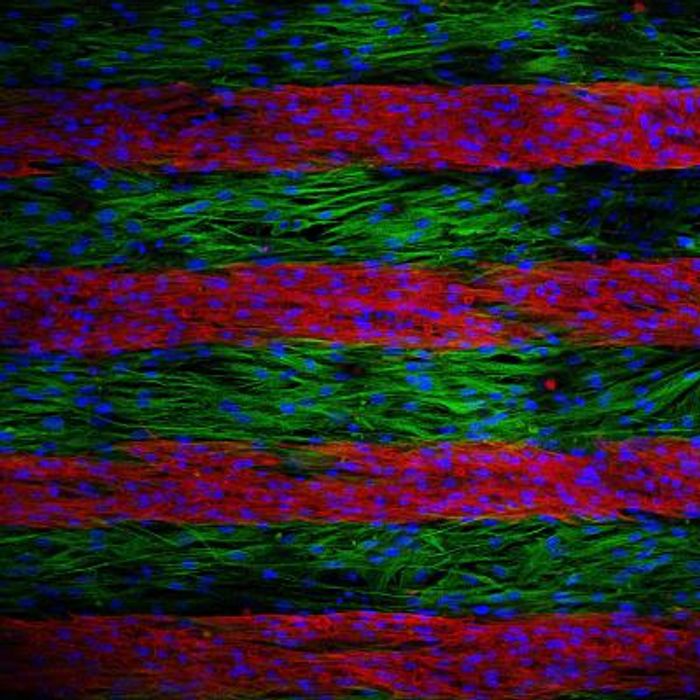 Parallel lines of cultured cells are stained to indicate if they are electrically conductive or not. Electrical signals trying to cross the culture is slowed by the inactive cells; after a genetic treatment, inactive cells become electrically active, speeding up the electrical signals as they move across the lines./Credit: Nenad Bursac, Duke University