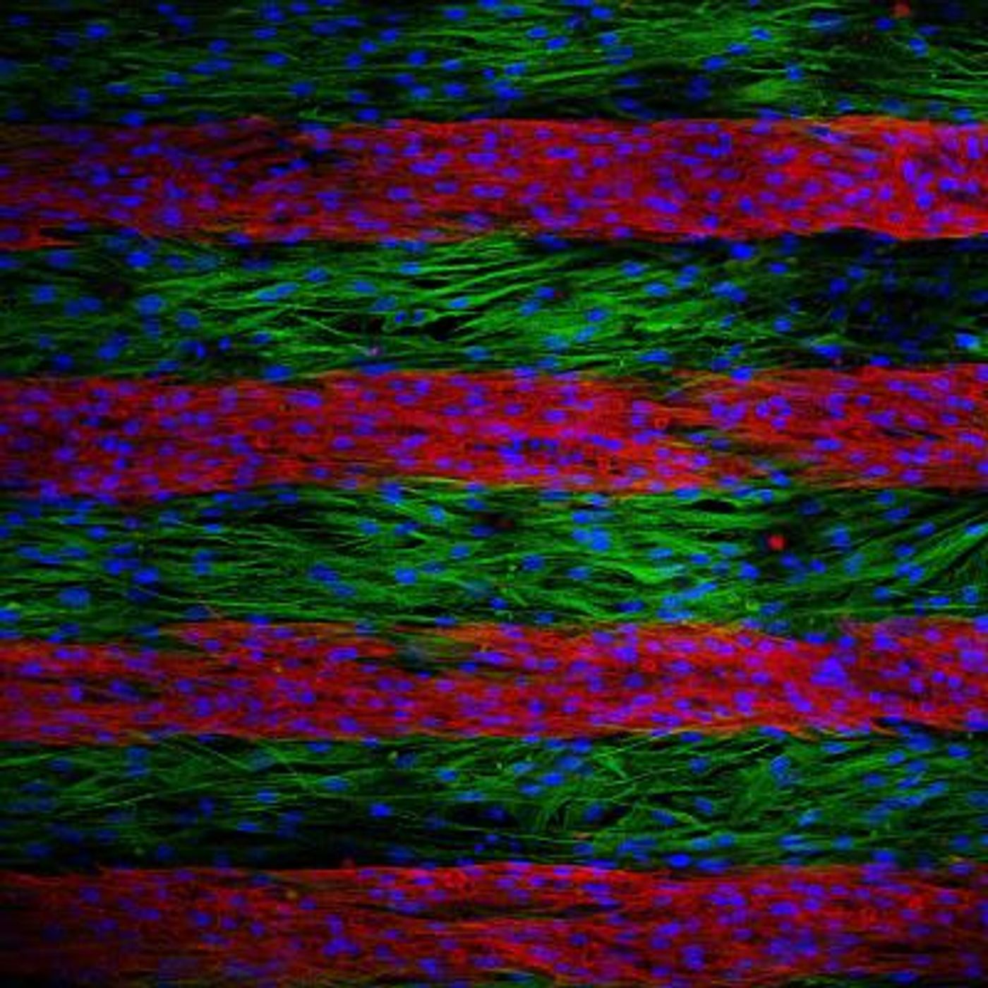 Parallel lines of cultured cells are stained to indicate if they are electrically conductive or not. Electrical signals trying to cross the culture is slowed by the inactive cells; after a genetic treatment, inactive cells become electrically active, speeding up the electrical signals as they move across the lines./Credit: Nenad Bursac, Duke University