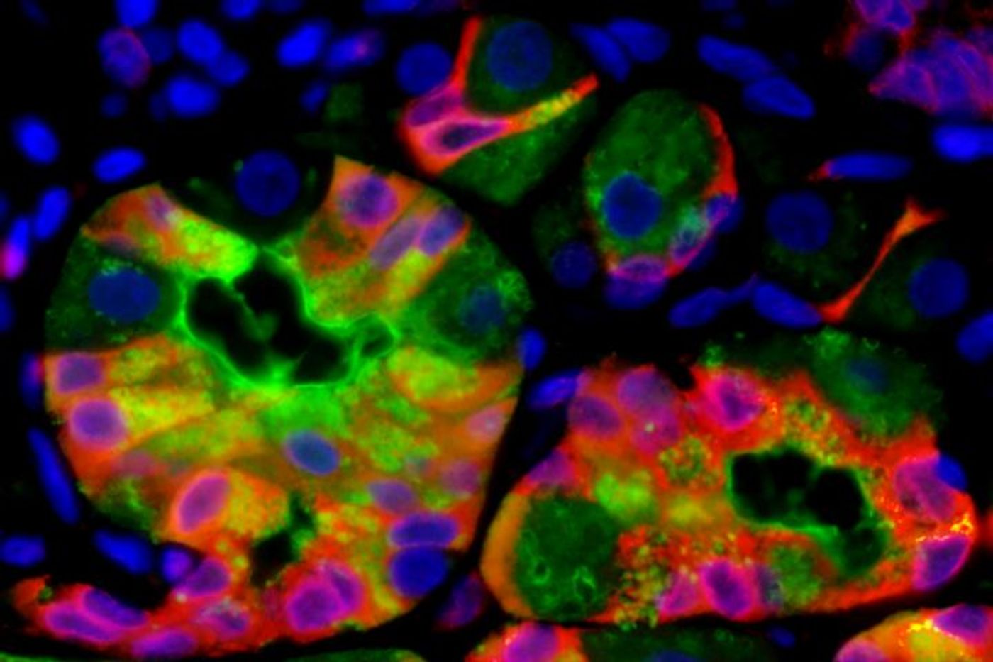 Researchers at Washington University School of Medicine in St. Louis have found that when mature cells transition to begin dividing again, they all seem to do it the same way, regardless of what organ those cells come from. Shown are stomach cells transitioning from a mature to a stem cell-like state. / Credit: Washington University School of Medicine