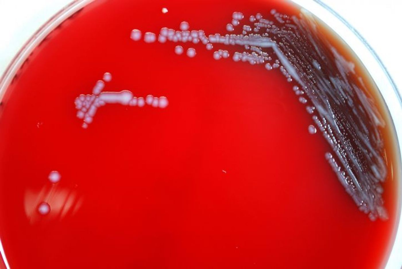 Enterobacteriaceae bacteria / Credit: Pixnio