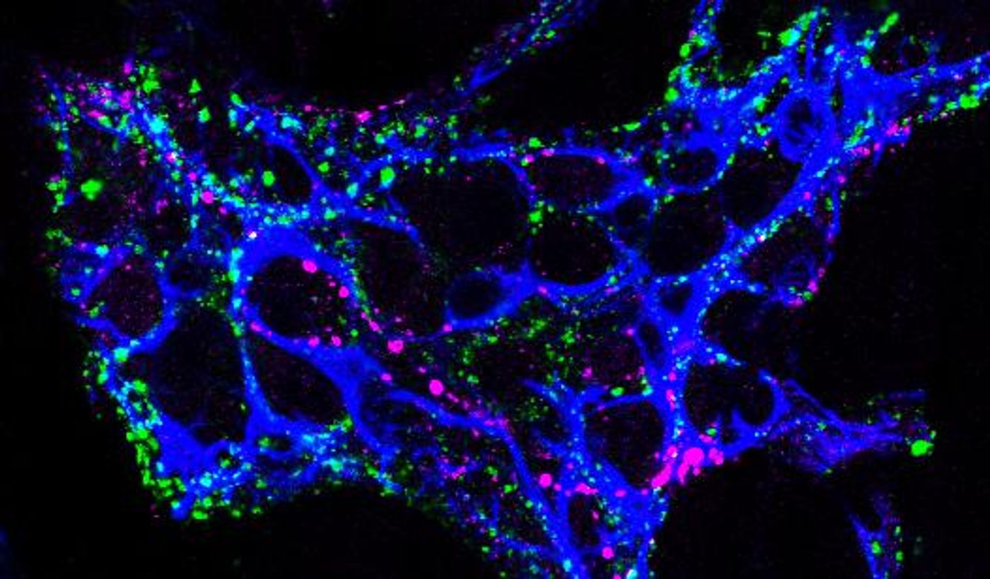 Michigan State University scientists have identified an early cause of intestinal inflammation, one of the first stages of inflammatory bowel disease and irritable bowel syndrome, which afflict around 11 percent of the world's population. / Credit: Courtesy of MSU