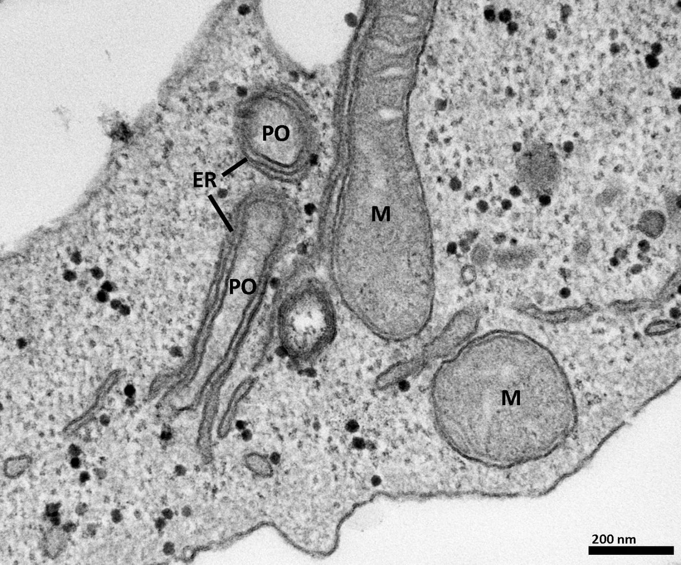 Close interaction of the endoplasmic reticulum (ER) with peroxisomes (PO) in cultured cells is shown by electron microscopy. M, mitochondria. / Credit: University of Exeter