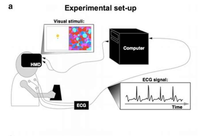 Experimental set-up for synchronizing the visual stimuli to the subject's heartbeat.