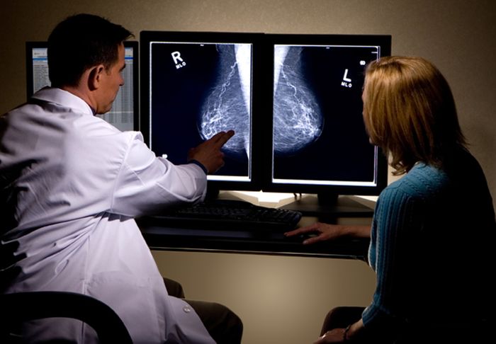 Researchers are working to incorporate false positive mammograms into improved risk-prediction.