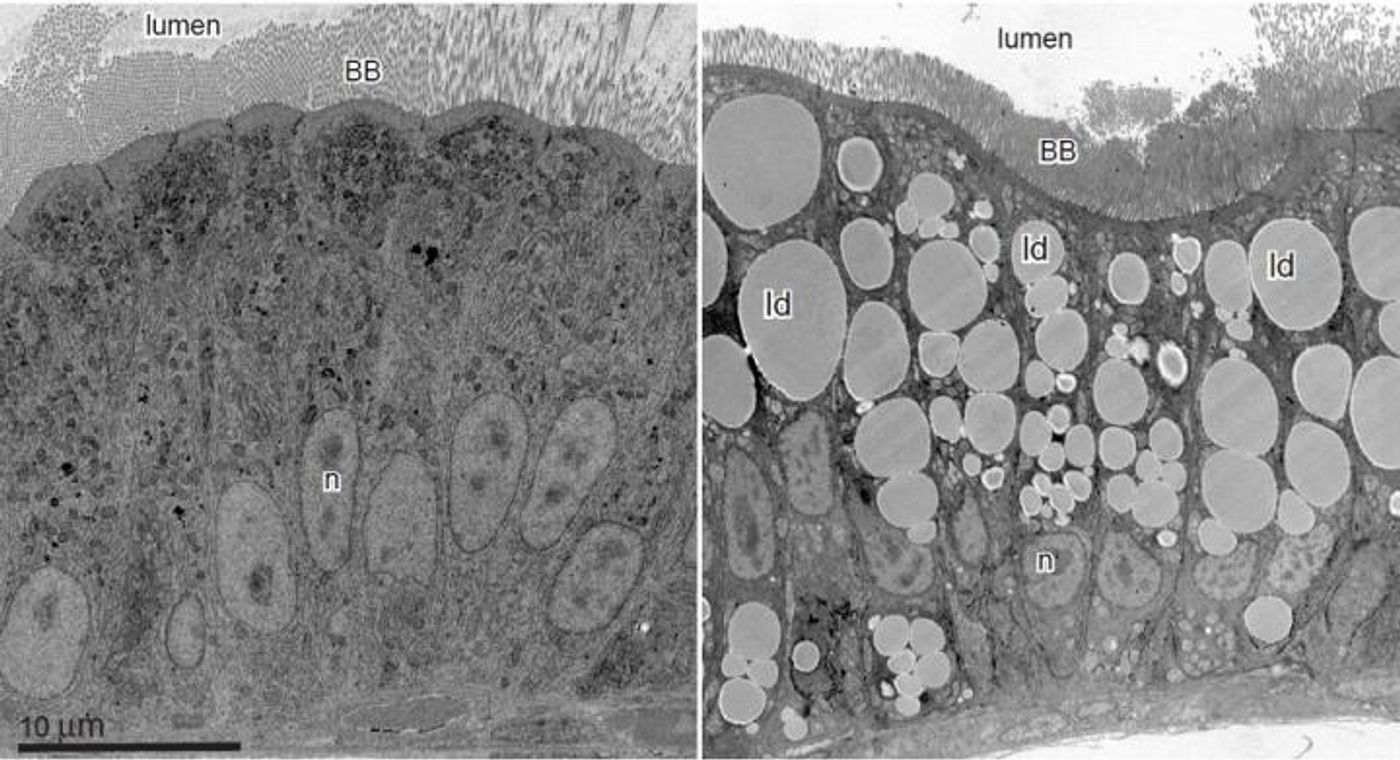 The research team found that fatty food consumption causes the cells that line our intestines to do some interior remodeling. One such shape shift occurs in the nucleus, where the cell's DNA is stored. The team demonstrated that the nucleus takes on a rapid and reversible ruffled appearance after fatty food is consumed, which is shown in this image. / Credit: Image is provided courtesy of Steven Farber and Erin Zeituni