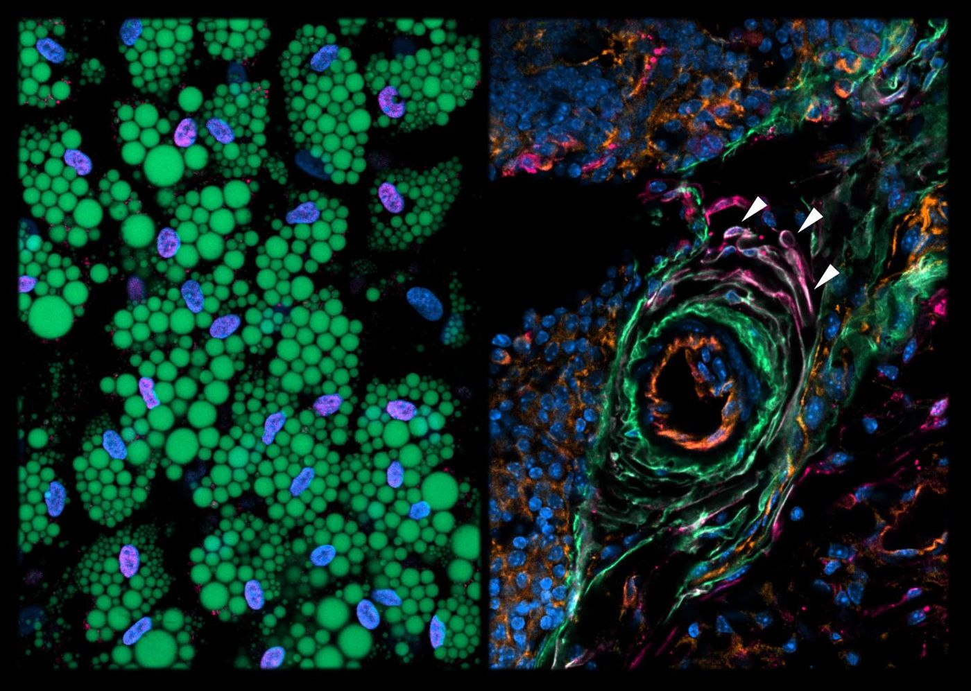 Two different aspects of fat: left, mature human fat cells grown in a Petri dish (green: lipid droplets); right, a section of mouse fat tissue with in the middle, a blood vessel (red circle) surrounded by Aregs (arrows), newly discovered cells capable of suppressing adipogenesis. CREDIT Bart Deplancke/EPFL