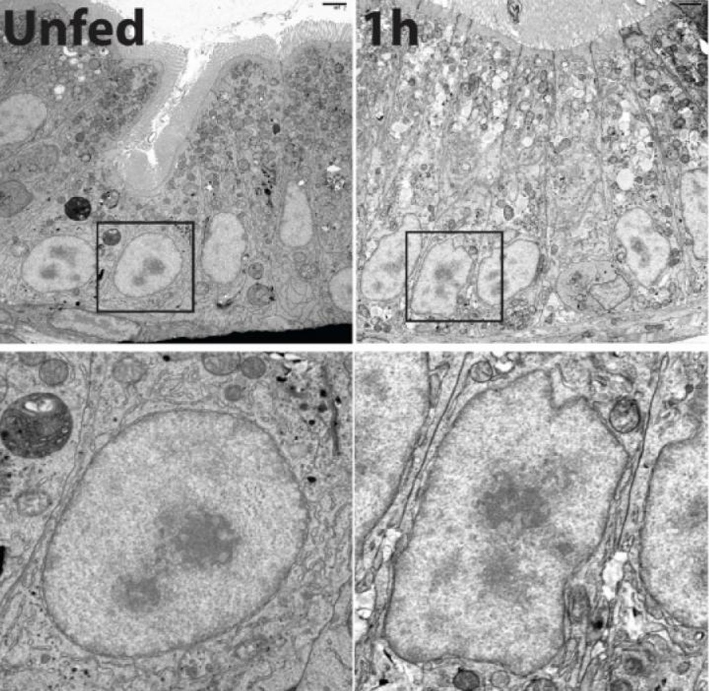 This is a comparison between an enterocyte cell before and after a fatty meal. Enterocytes are specialized cells that line the insides of our intestines. They grab and absorb nutrients from food as it is digested, including the lipid molecules from fatty foods. 'This is exactly what your intestine looks like after a cheeseburger,' said Carnegie's Steven Farber. / Credit: Image is provided courtesy of Farber and Erin Zeituni.