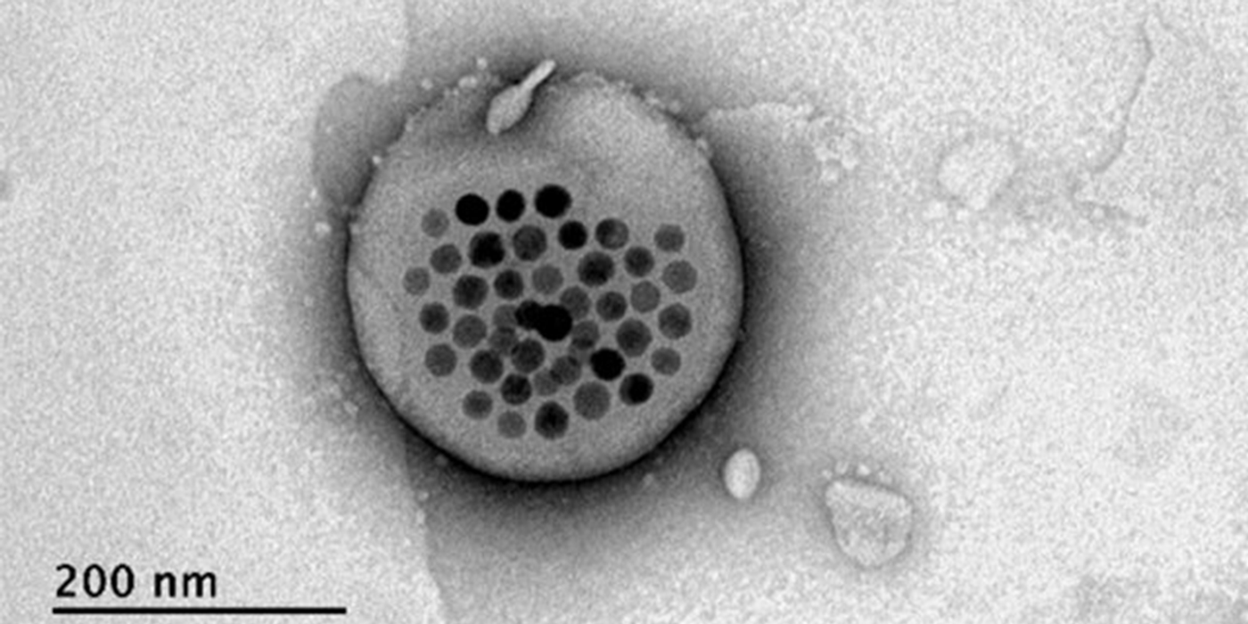 Electron microscope image showing iron oxide particles inside a liposome "bubble" (MIT)
