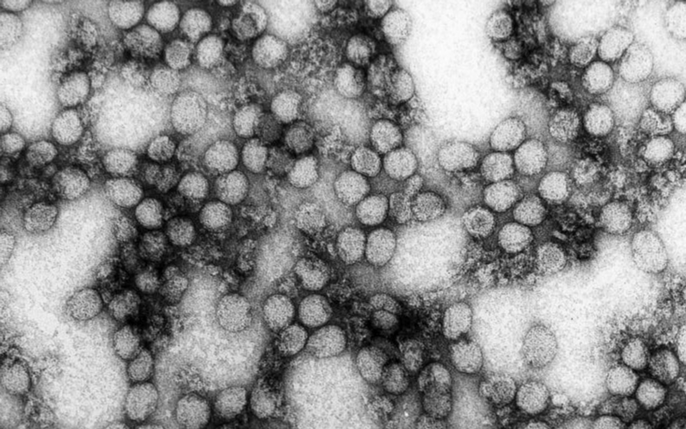 The yellow fever virus. Credit: CDC Public Health Image Library