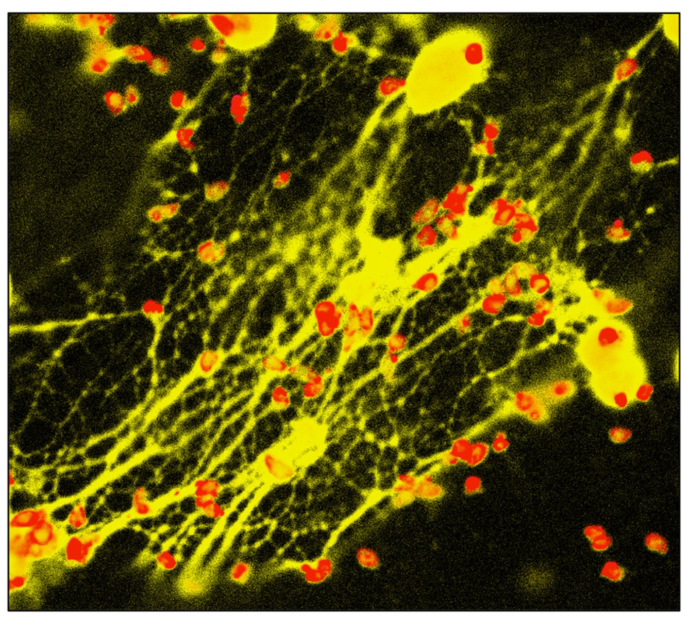 Pathogens (red) trapped by NETs (yellow)