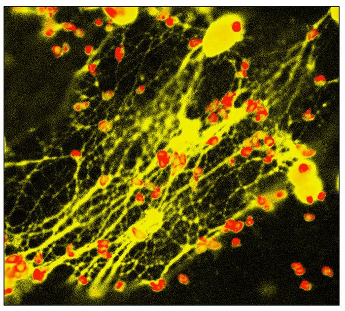 Pathogens (red) trapped by NETs (yellow)