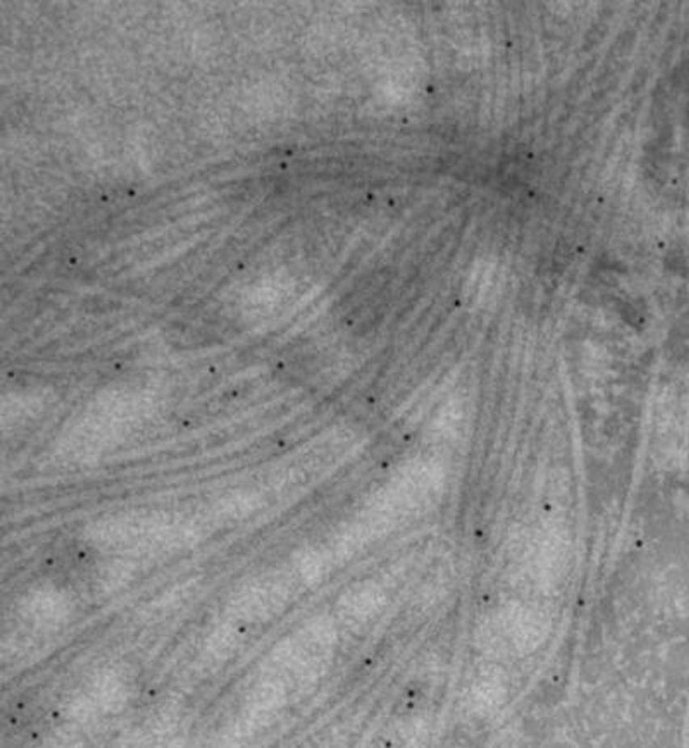This is a a transmission electron microscope (TEM) image of isolated flagella from Clostridium haemolyticum. Black dots indicates the location of the newly discovered enzyme. / Credit: University of Waterloo