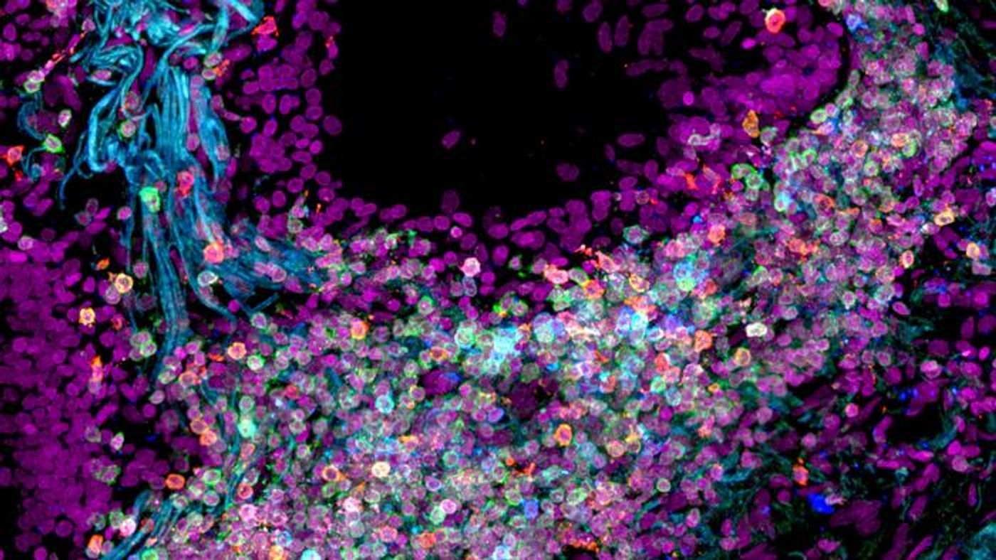 Human lung tissue / Credit: Nathan Richoz University of Cambridge