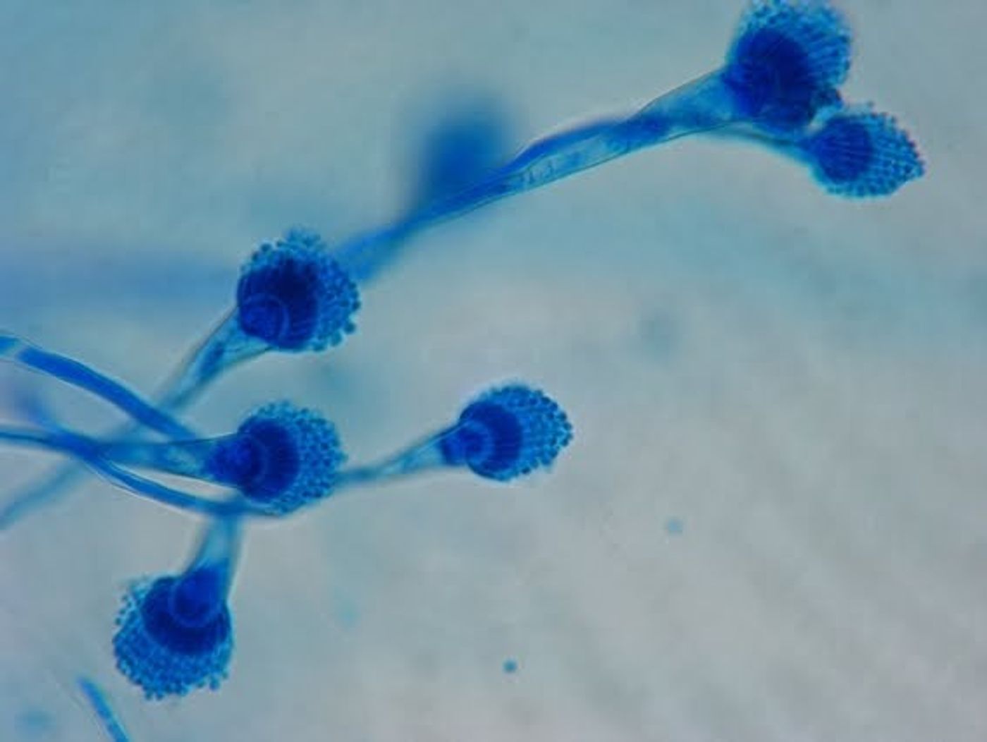 Aspergillus causes serious infections in the immunocompromised.