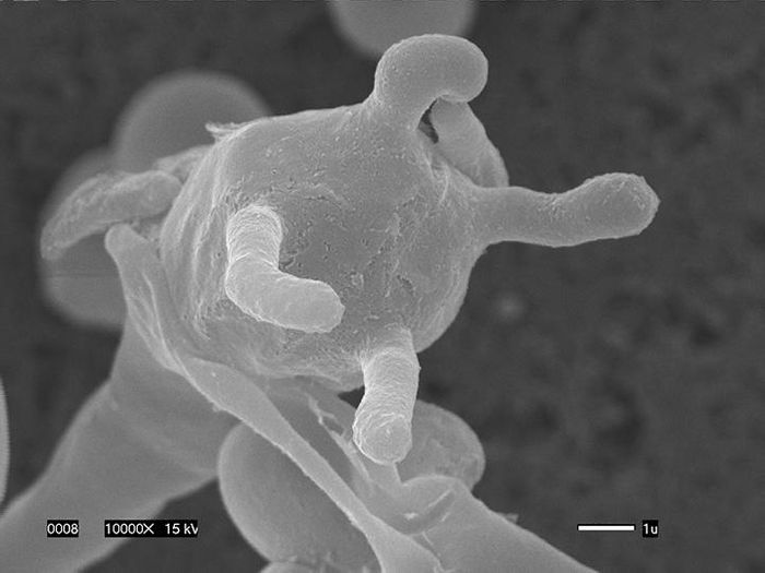 This image shows spores on the surface of a fruiting structure from the fungus Cryptococcus deuterogattii, a deadly strain that emerged in the Pacific Northwest. / Credit: Edmond Byrnes III, Joseph Heitman -- Duke; Valerie Knowlton - NC State