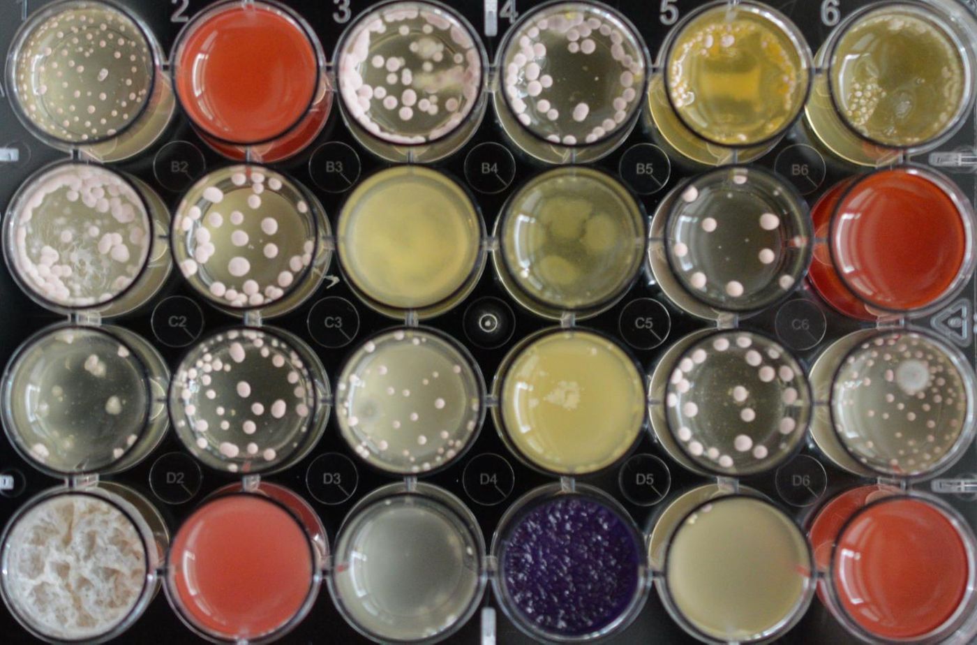 Microorgansims like fungi can be cultivated in the laboratory and stimulated with distinct substances for production of antibiotic metabolic products. / Credit: BiMM Research/Bioactive Microbial Metabolites