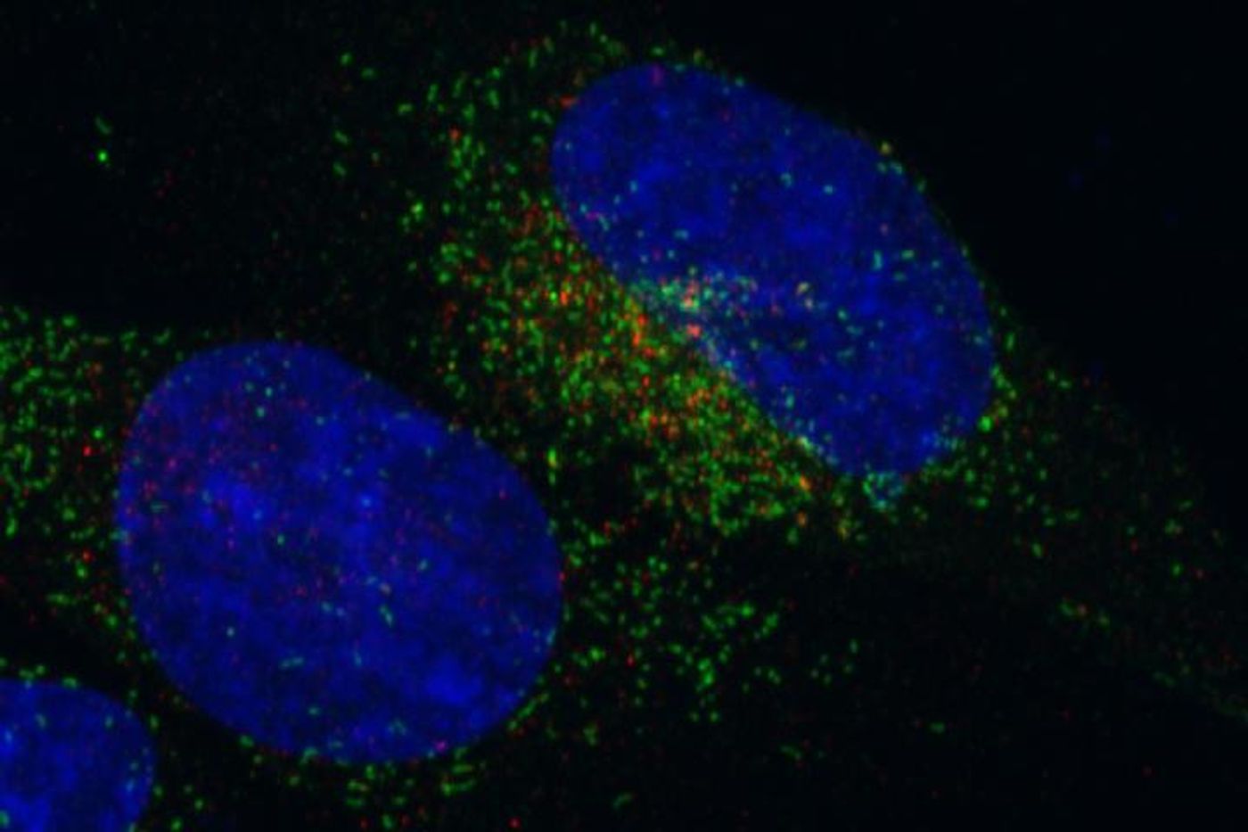 Central nervous system cells expressing the FGFR3-TACC3 fusion protein. / Credit: Iavarone Lab, Columbia University Medical Center