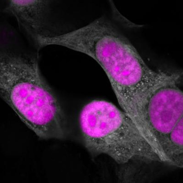 CasRx (magenta) targeting RNA in the nucleus of human cells (gray). / Credit: Salk Institute