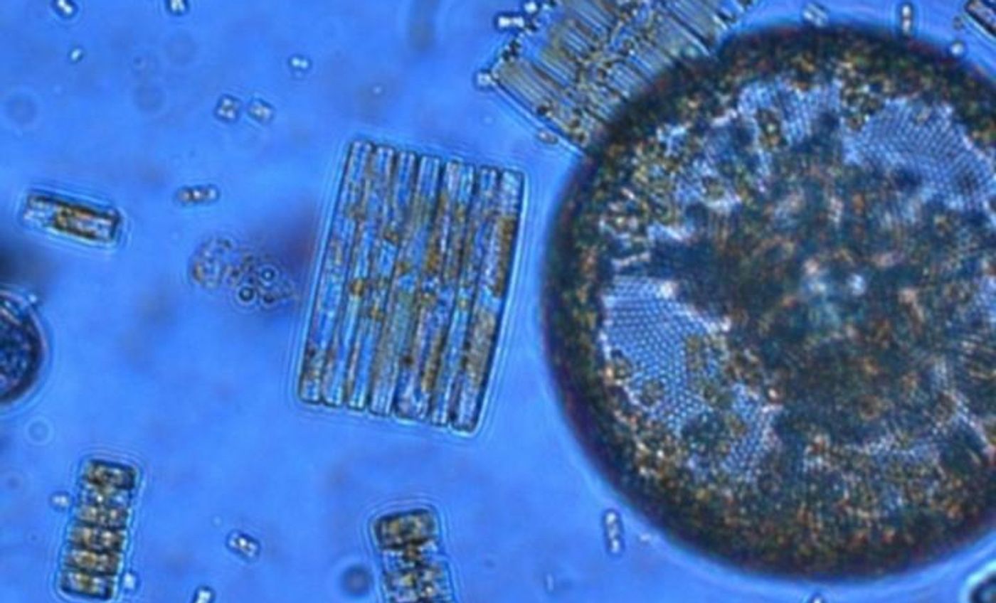 Photosynthetic plankton like these Ross Sea diatoms are key players in the global carbon cycle and form the base of marine food webs, but a new study reveals their ability to acquire iron is highly sensitive to ocean acidification. / Credit: Jeff McQuaid