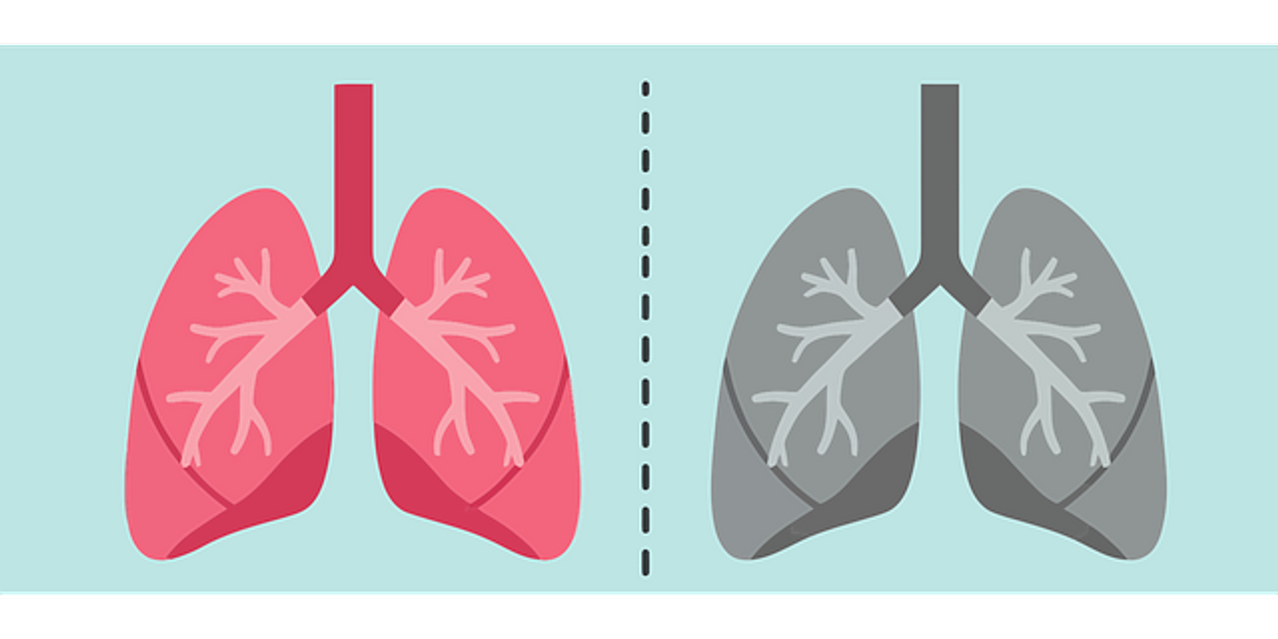 A Dual Immunotherapy Approach for Treating Lung Cancer | Cancer