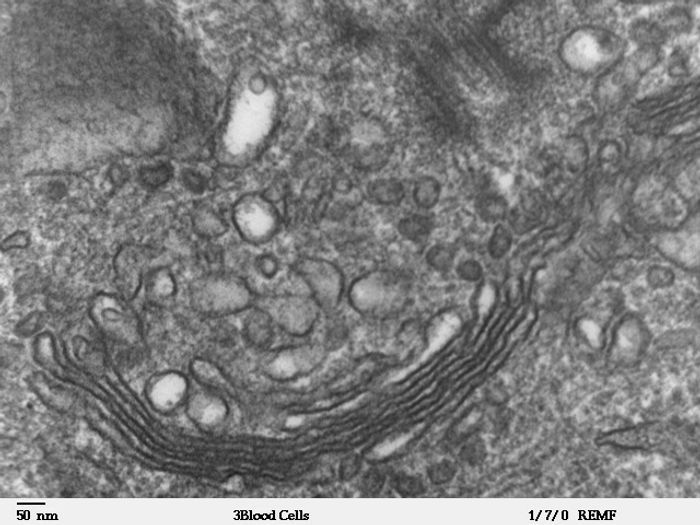High magnification transmission electron microscope image of a human leukocyte, showing golgi, which is a structure involved in protein transport in the cytoplasm of the cell. / Credit: Louisa Howard