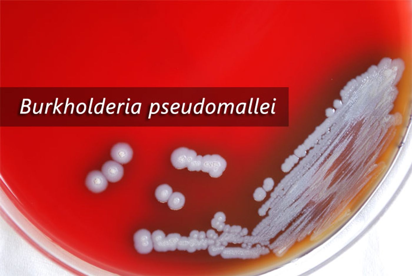 B. pseudomallei colonies grow on a culture plate.