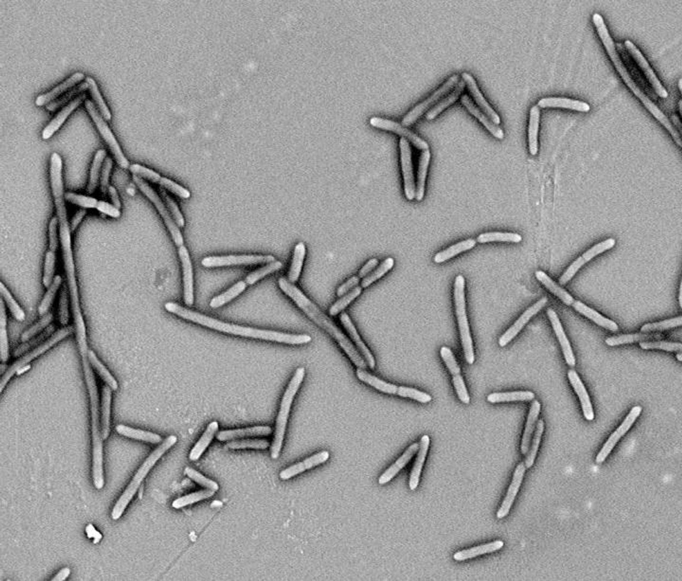 This is gut bacteria in culture. / Credit: Tao Liu and Xiaoyan Pang/Shanghai Jiao Tong University
