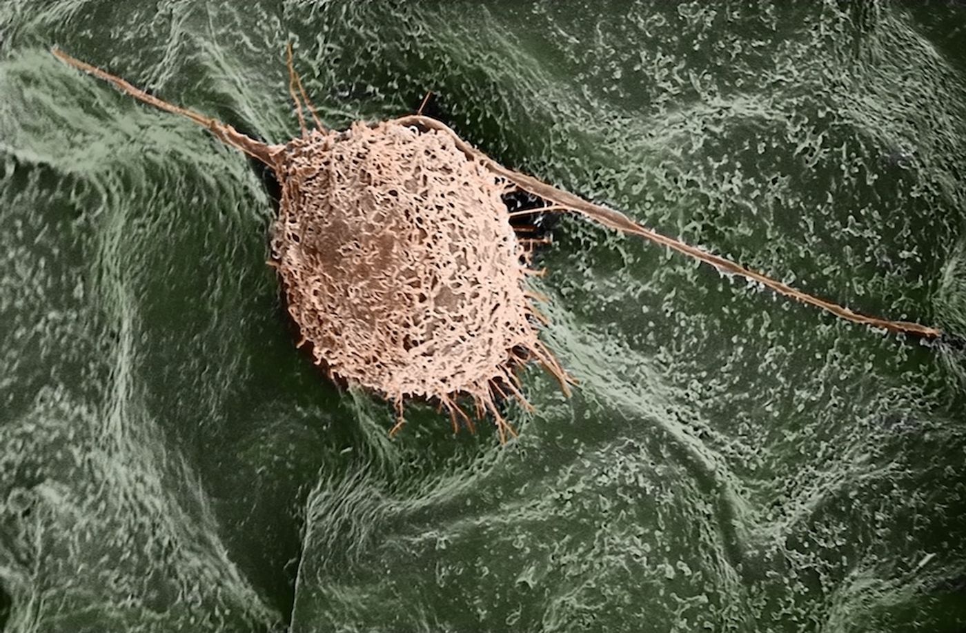 A human fibroblast cell finds a home on a lilac leaf. / Credit: Gianluca Fontana