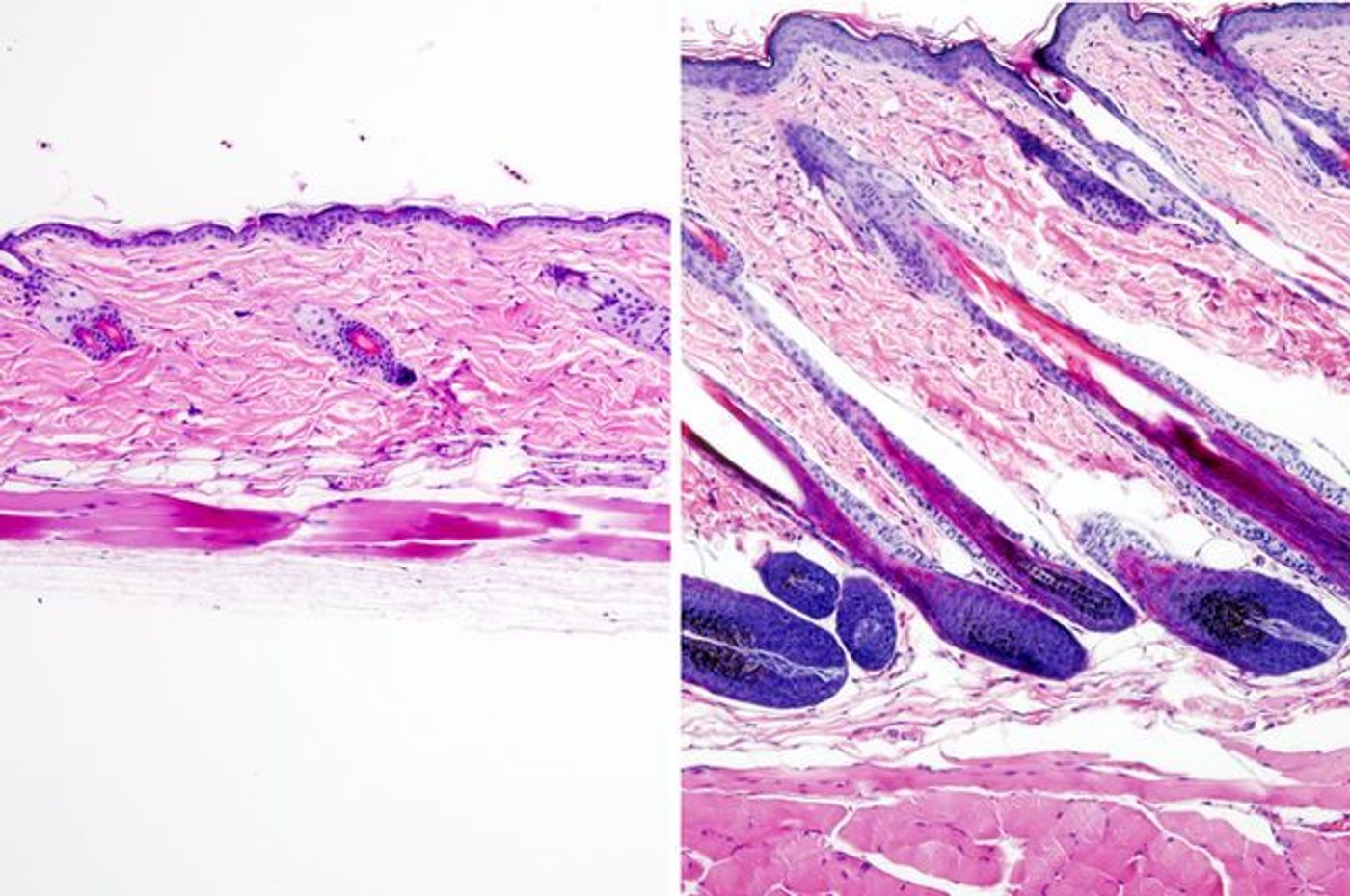 Untreated mouse skin showing no hair growth, left, compared to mouse skin treated with the drug UK5099 showing hair growth. / Credit: UCLA Broad Stem Cell Center/Nature Cell Biology