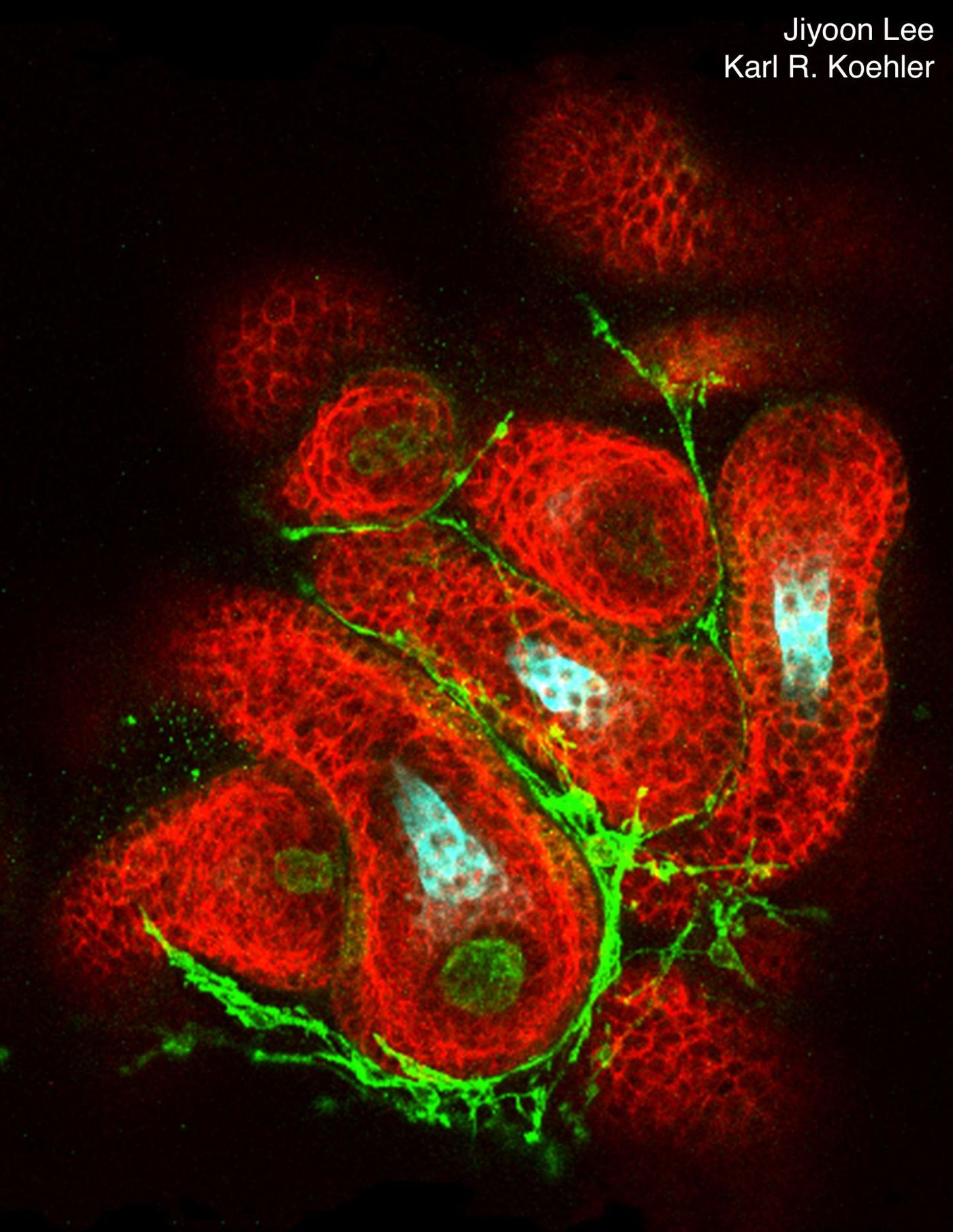 Lee et al. show that hair follicles can be generated from mouse pluripotent stem cells in a 3-D cell culture system. The hair follicles (red) grow radially out of spherical skin organoids and contain follicle-initiating dermal papilla cells (green cells) and hair shafts (cyan). / Credit: Artwork by Jiyoon Lee and Karl Koehler.