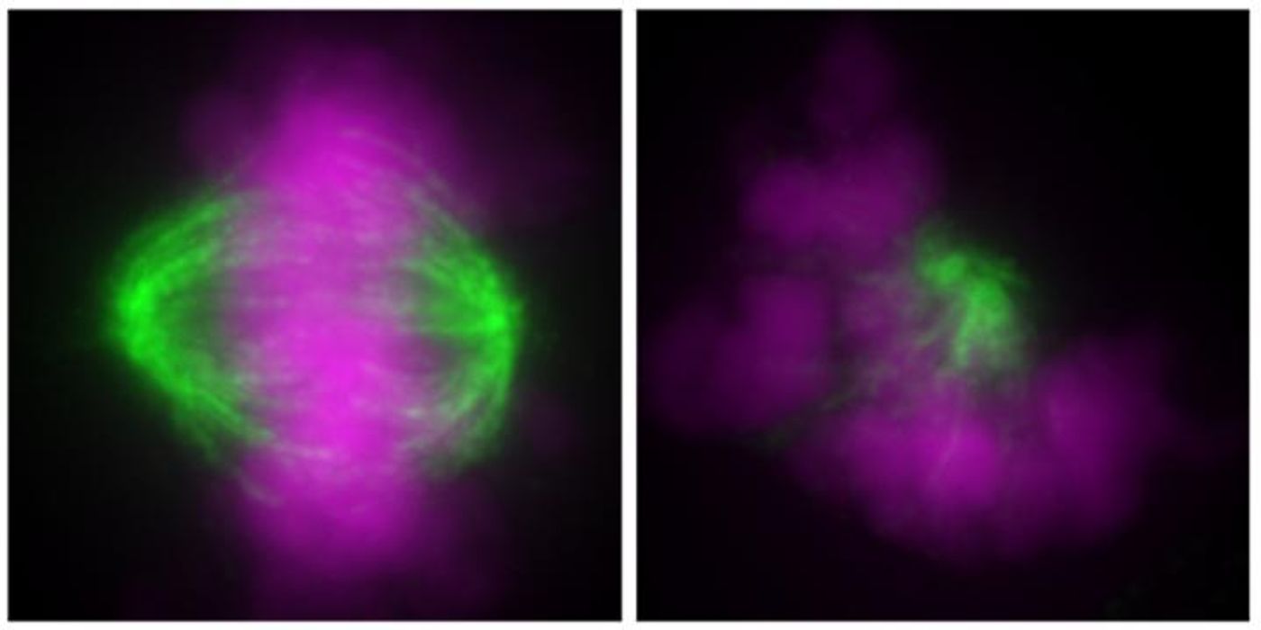 A diploid cell (left) and a haploid cell (right) showing normal and abnormal orientation of chromosomes (purple) and microtubules (green) during cell division, respectively. / Credit/Copyright: Yaguchi K., et al., Journal of Cell Biology, April 30, 2018