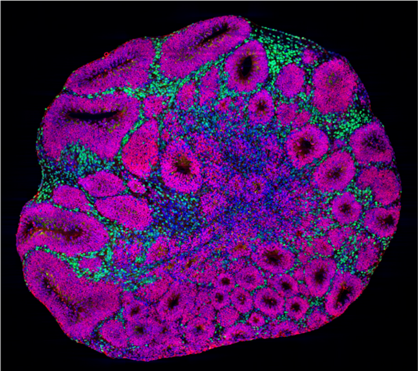 Microscopy image of a brain organoid showing neuron precursors (magenta) and deep-layer projection neurons (green), which are one of the cell types affected by autism risk gene mutations. / Credit: Paola Arlotta laboratory at Harvard University and Kwanghun Chung laboratory at MIT/©/All Rights Reserved