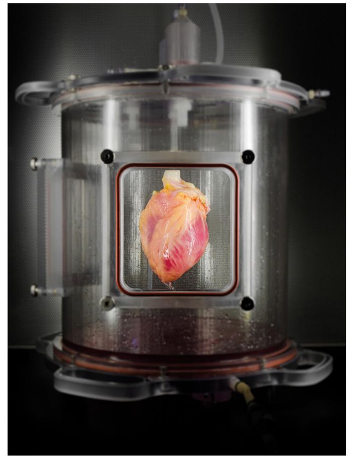 A partially recellularized human whole-heart cardiac scaffold, reseeded with human cardiomyocytes derived from induced pluripotent stem cells, being cultured in a bioreactor that delivers a nutrient solution and replicates some of the environmental conditions around a living heart.