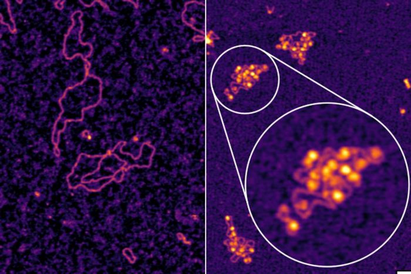 Atomic force microscopy images show hepatitis B DNA in its natural state (left) & zoomed-in (right), how it wraps around human histones during an infection. / Credit: Memorial Sloan Kettering Cancer Center