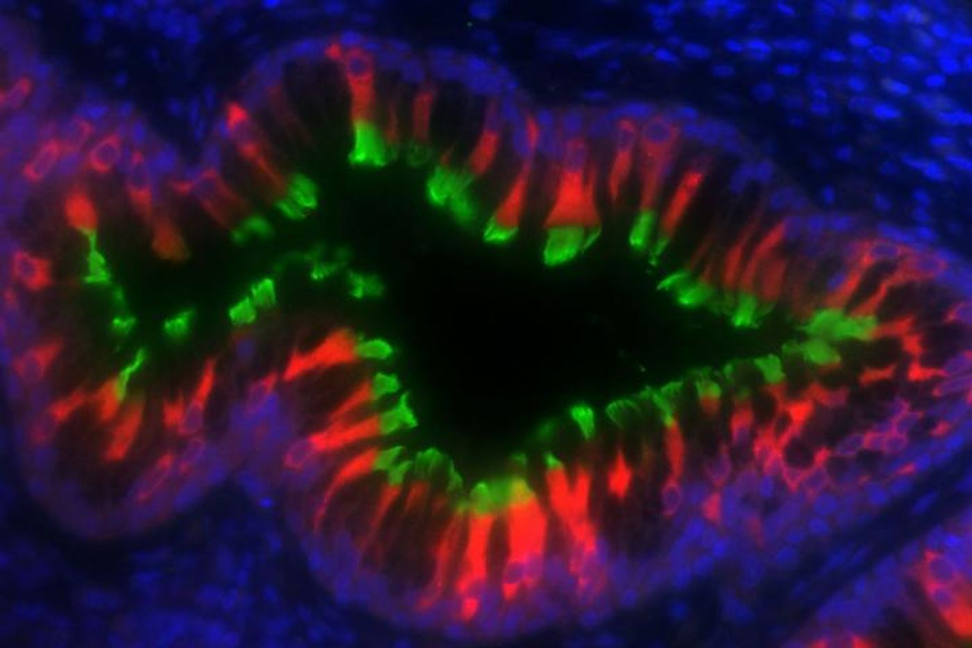 The HEATR2 protein (red) is located in the body of airway cells lining the trachea, not in the cilia (green) or the nuclei (blue). Finding HEATR2 outside of the cilia was the first clue for Amjad Horani, MD, and Steven Brody, MD, that the protein did not form part of the cilia's motor. Later, they discovered that HEATR2 formed the scaffold on which the motor was built. / Credit: Amjad Horani