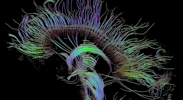 Reconstructed fiber tracts that run through the mid-sagittal plane of the human brain / Credit: Wikimedia Commons/Thomas Schultz