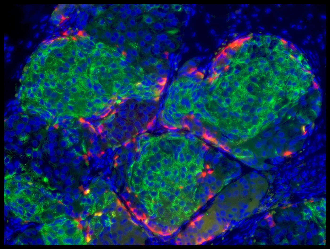 Human-stem-cell-derived beta cells that have formed islet-like clusters in a mouse. Credit: Harvard Magazine