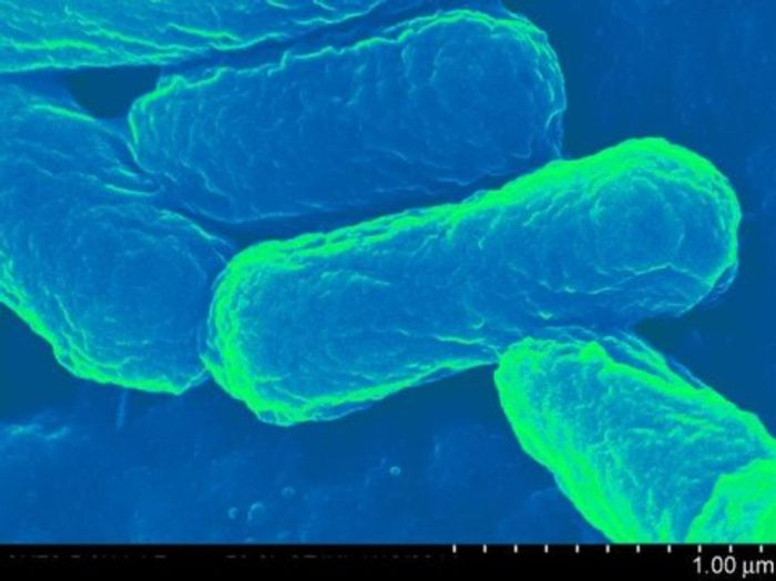 Escherichia coli / Credit: University at Buffalo