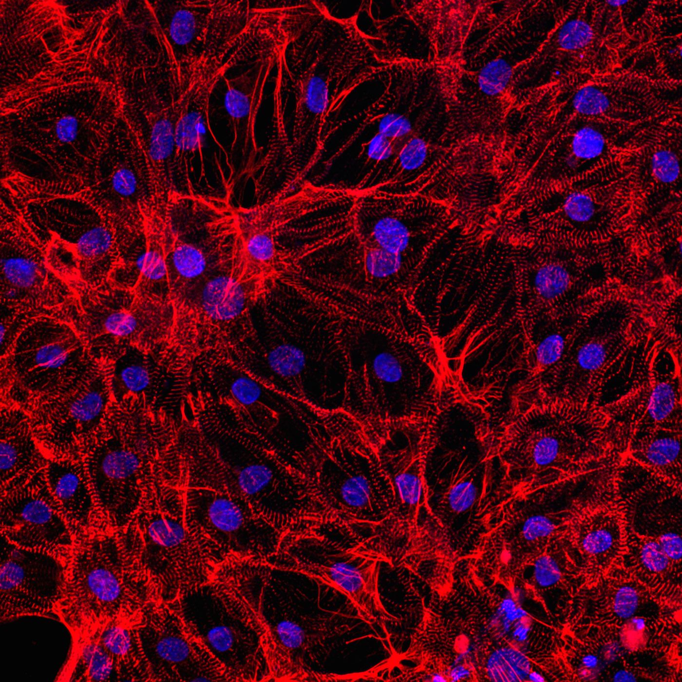 Human induced pluripotent stem cell-derived cardiomyocytes. Source: Axol Bioscience