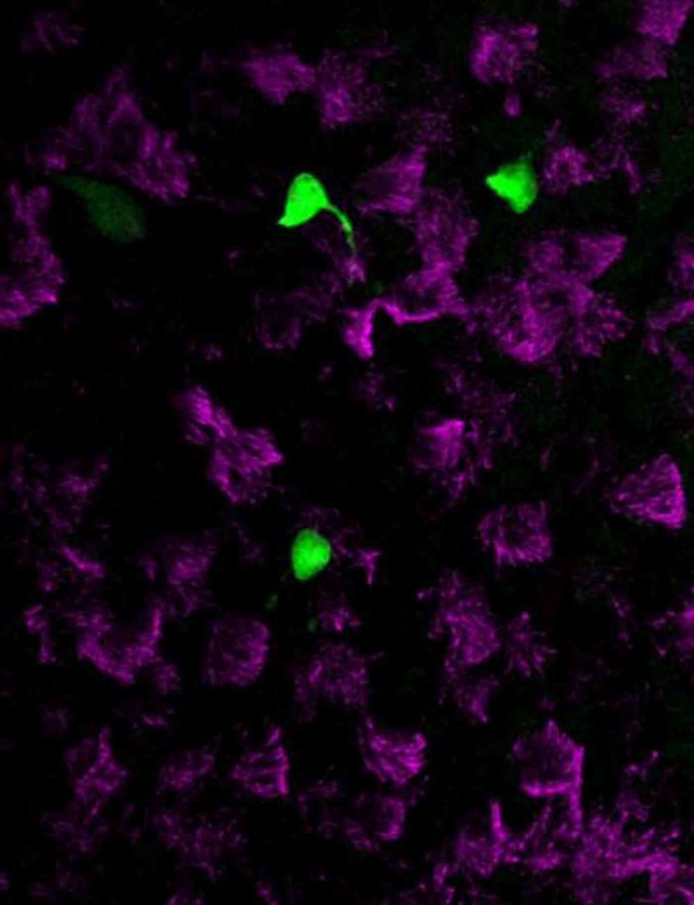 Newly identified, rare pulmonary ionocytes (green) dot the landscape of ciliated cells (magenta) of the mouse lung airway lining. / Credit: Montoro et al./Nature 2018