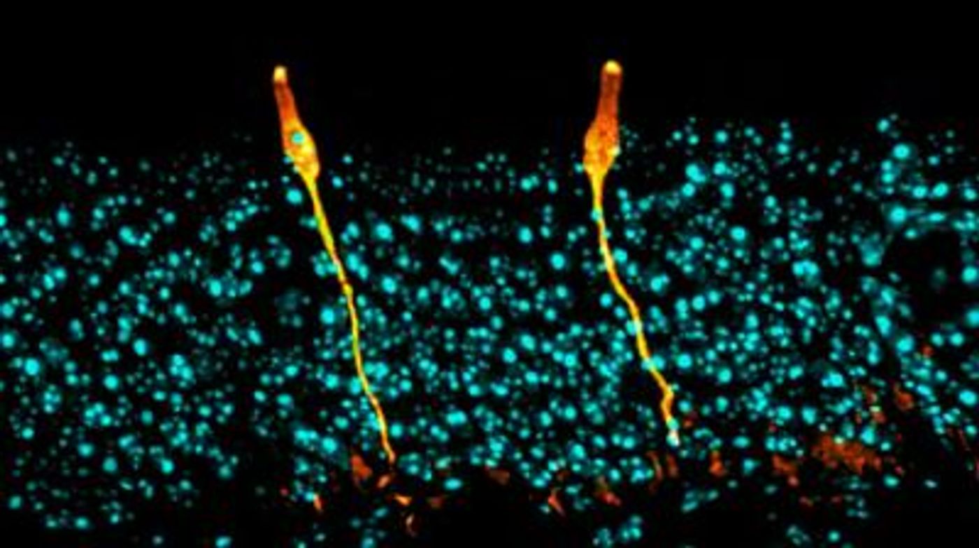 Pulmonary ionocytes (orange) extend through neighboring epithelial cells in the upper respiratory tract of the mouse, to the surface of the epithelial lining. Cell nuclei in cyan. / Credit: Montoro et al./Nature 2018