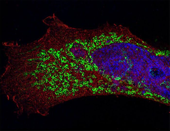 A human epithelial cell infected with H3N1 influenza A virus (in green). Red, LC3 (cytosolic protein); blue, DNA. Imaged by super-resolution structured illumination microscopy. 50 Z-stacked images. Credit: Maria T. Sanchez, Mount Sinai School of Medicine